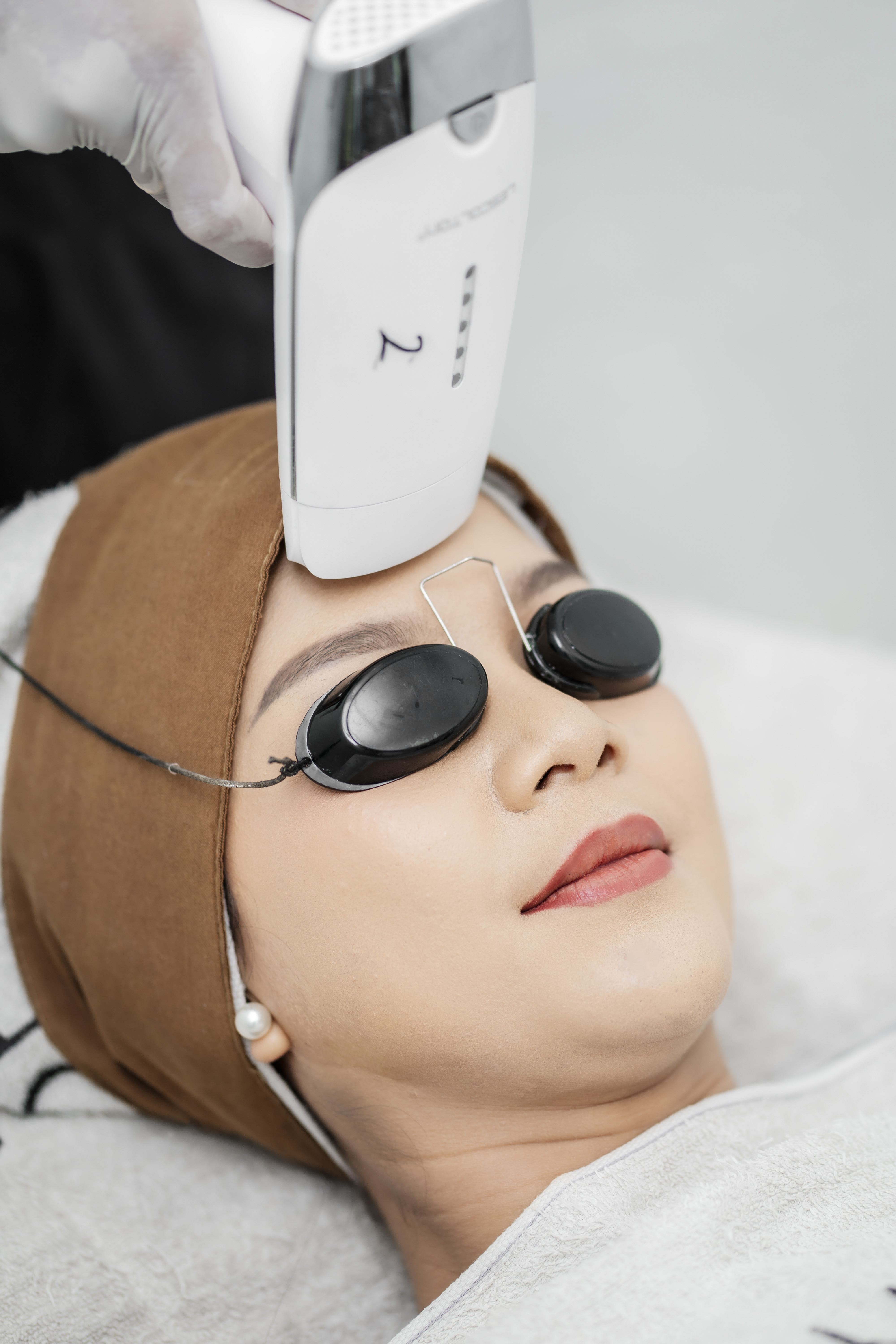 Facial IPL Acne Skin